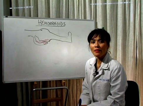 How to Cure Hemorrhoids : What Causes Hemorrhoids? | Hemorrhoid Treatment