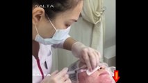 girl botox face botoks videos video / fille botox visage botoks vidéos