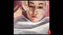 botox face botoks videos video girl  / fille botox visage botoks vidéos