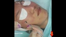 video girl black point removal / retrait du point noir maquillage fille vidéo