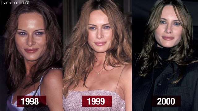 تطور شكل Melania Trump وأسلوبها الجمالي عبر السنين