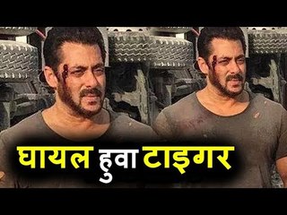 Salman Khan हुए घायल | Tiger Zinda Hai सेट पे शूट के दौरान