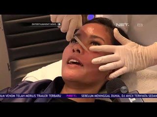 Download Video: Titi Rajo Bintang Menjalani Treatment Laser Clear And Brilliant