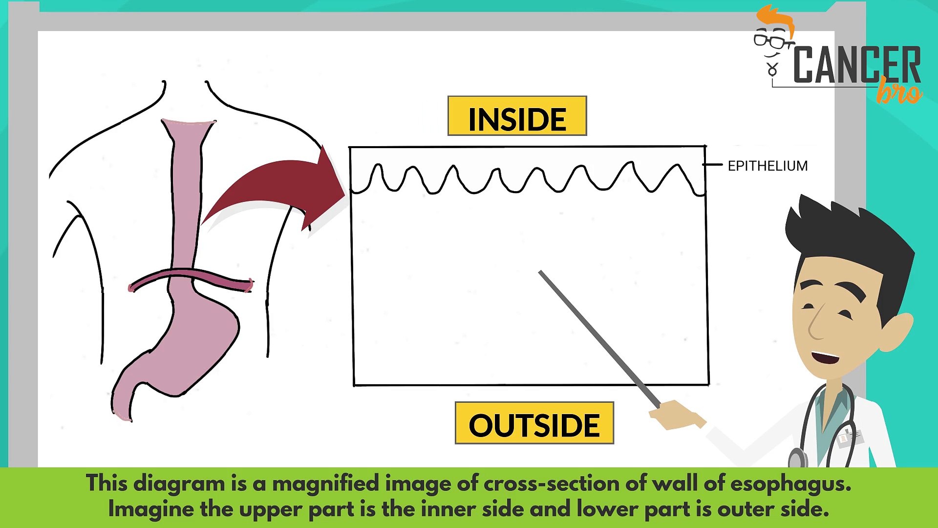 Esophageal cancer staging