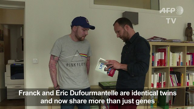 More than skin deep: how brotherly bond saved French burn victim