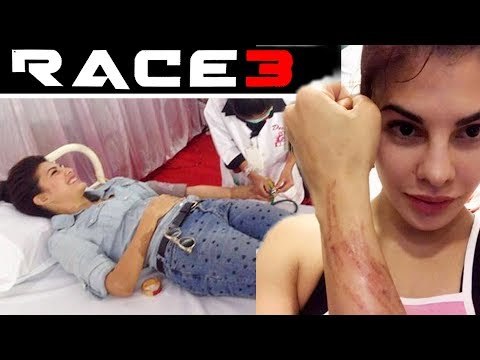 सलमान के रेस 3 शूट के दौरान जैकलिन हुई बुरी तरह घायल