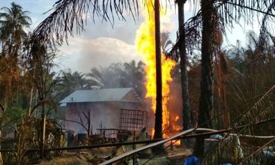 3 Pasien RSUZA Korban Ledakan Sumur Minyak Aceh Meninggal