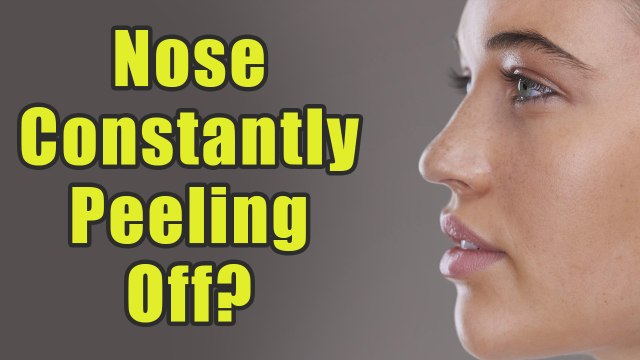 Is Your Skin On Both The Sides Of Your Nose Constantly Peeling Off? Try These Remedies | Boldsky