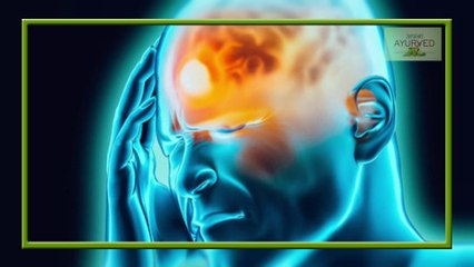 Ayurvedic cure of Headache || सर दर्द के रामबाण इलाज || Apna Ayurved