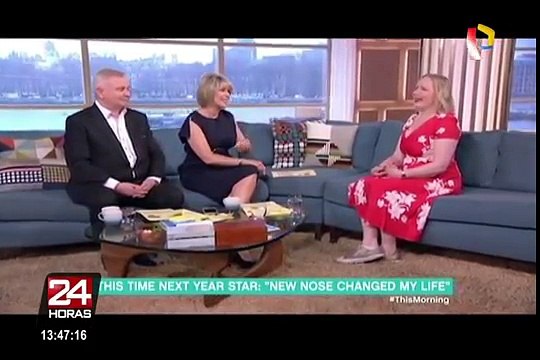 Reino Unido: prótesis magnética le cambió la vida a una mujer sin nariz