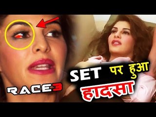 Jacqueline Fernandez's ACCIDENT On RACE 3 Sets - Hospitalized For Eye Injury