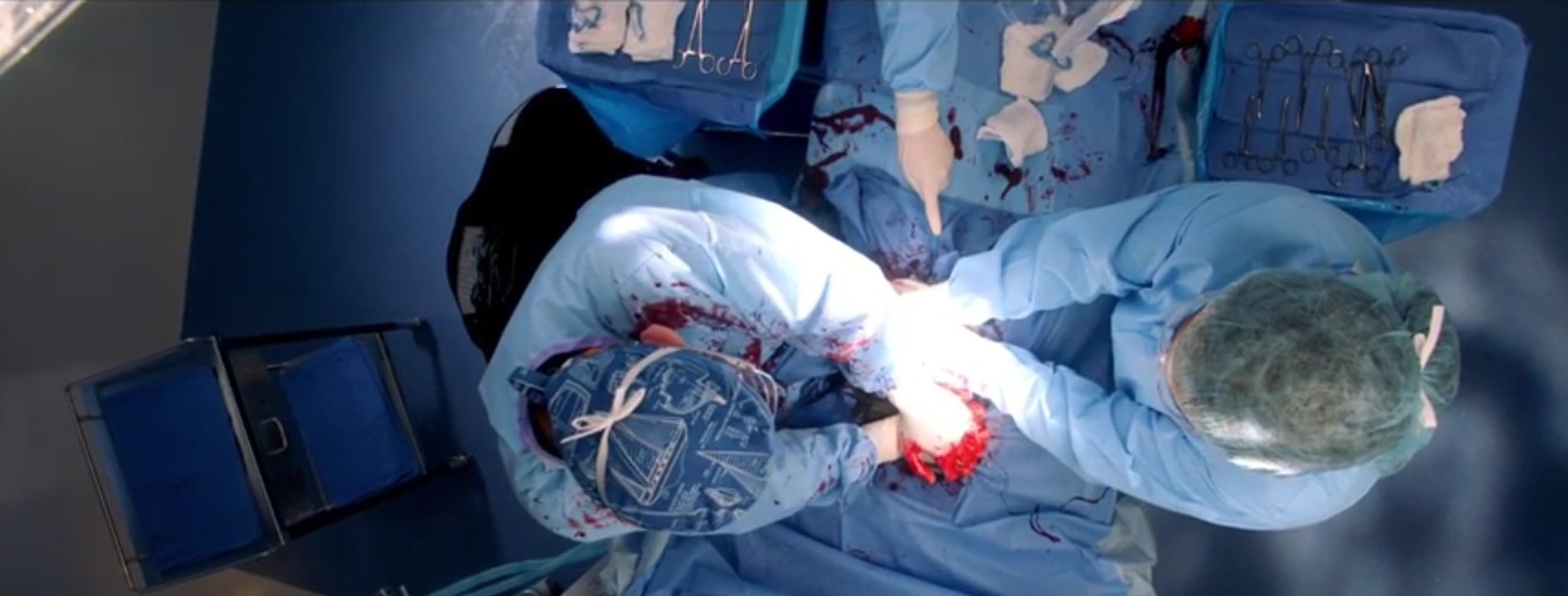 The Resident S01E12 - Rude Awakenings and The Raptor - Season 1 Episode 12