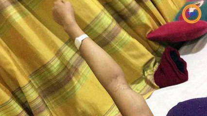 Un bras comme Popeye