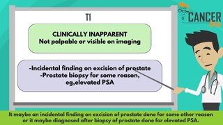Prostate cancer TNM staging