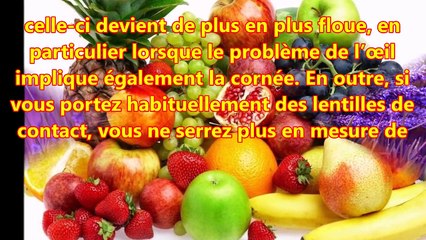 Le pterygion, causes et facteurs à risques
