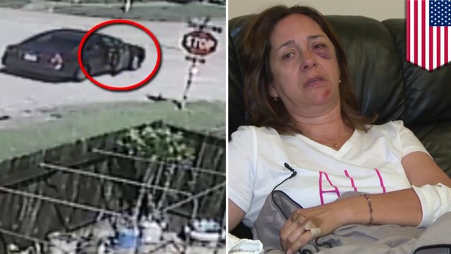 Scientists kept pig brains alive outside body for 36 hours