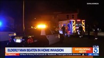 Elderly Man Pistol-Whipped in Brutal Home Invasion