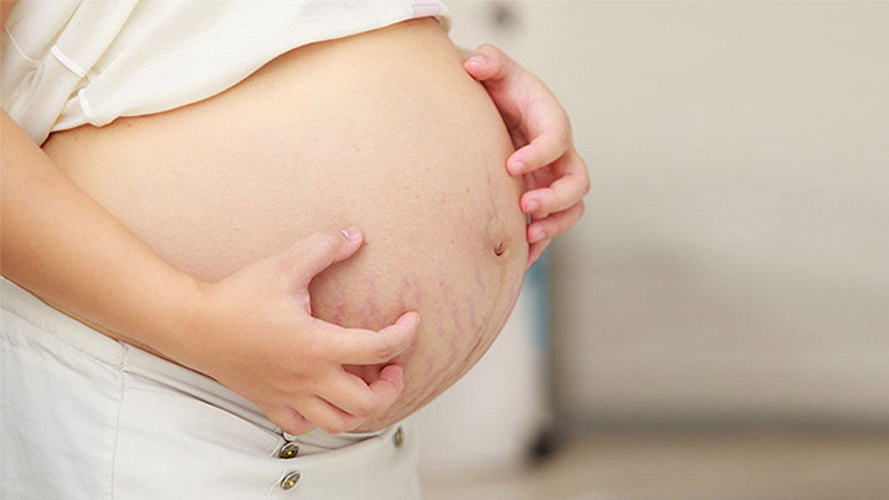 Pregnancy Itching: Home Remedies | प्रेगनेंसी म...