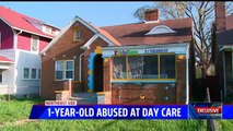 1-Year-Old Boy Brutally Beaten at Indiana Day Care