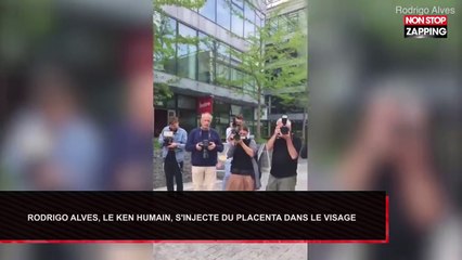 Rodrigo Alves : Quand le Ken humain s’injecte du placenta dans le visage (Vidéo)