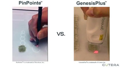 GenesisPlus - Size does matter. See how we measure up.