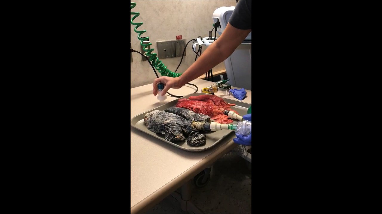 Cette vidéo d'un poumon de fumeur à coté d'un poumon sain va probablement réussir à vous faire arrêter de fumer