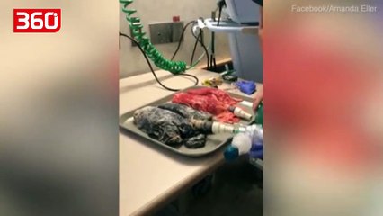 Shikoni krahasimin ndërmjet mushkërive të një duhanpirësi dhe një jo duhanpirësi, pamje shokuese (360video)