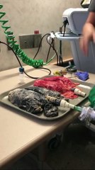 A diferença chocante entre o pulmão de um fumador e um pulmão saudável