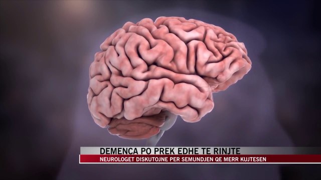 Sëmundja e kujtesës po prek edhe moshat e reja në Shqipëri - News, Lajme - Vizion Plus