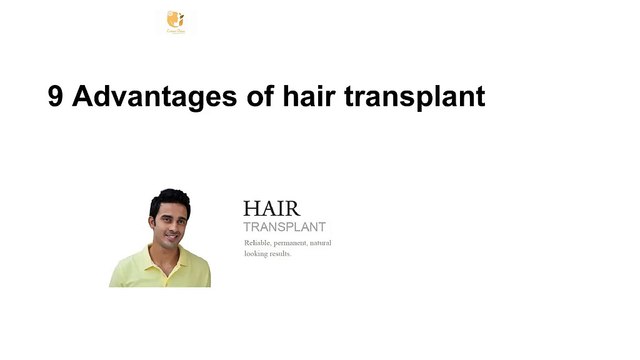 9 Advantages of hair transplant