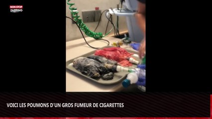 Voici les poumons d’un individu qui a fumé 20 cigarettes par jour pendant 20 ans (Vidéo choc)