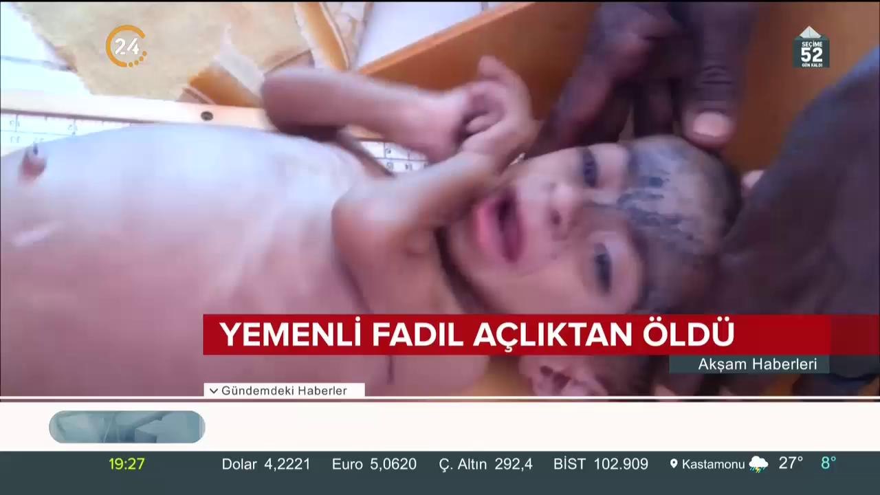 Yemen'de kıtlık