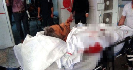 Avukat Katibi Haciz İçin Gitti, Gelinlikçi Silahla Bacağından Vurdu