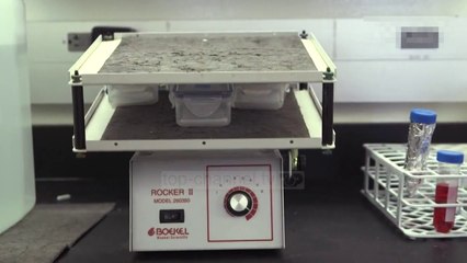 OKB: SIDA, në nivele alarmante në Europën Lindore - Top Channel Albania - News - Lajme