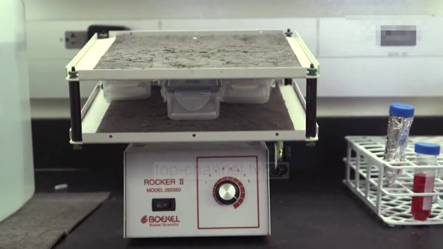 OKB: SIDA, në nivele alarmante në Europën Lindore - Top Channel Albania - News - Lajme