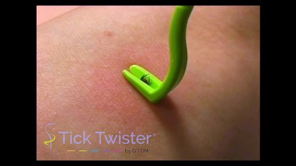 Comment retirer une tique