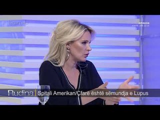 Rudina/ Semundja “Lupus”, cilat jane simptomat e para (18.10.17)