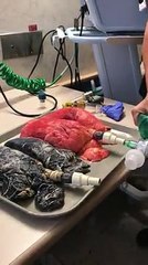Elle compare le poumon d'un fumeur à un poumon sain