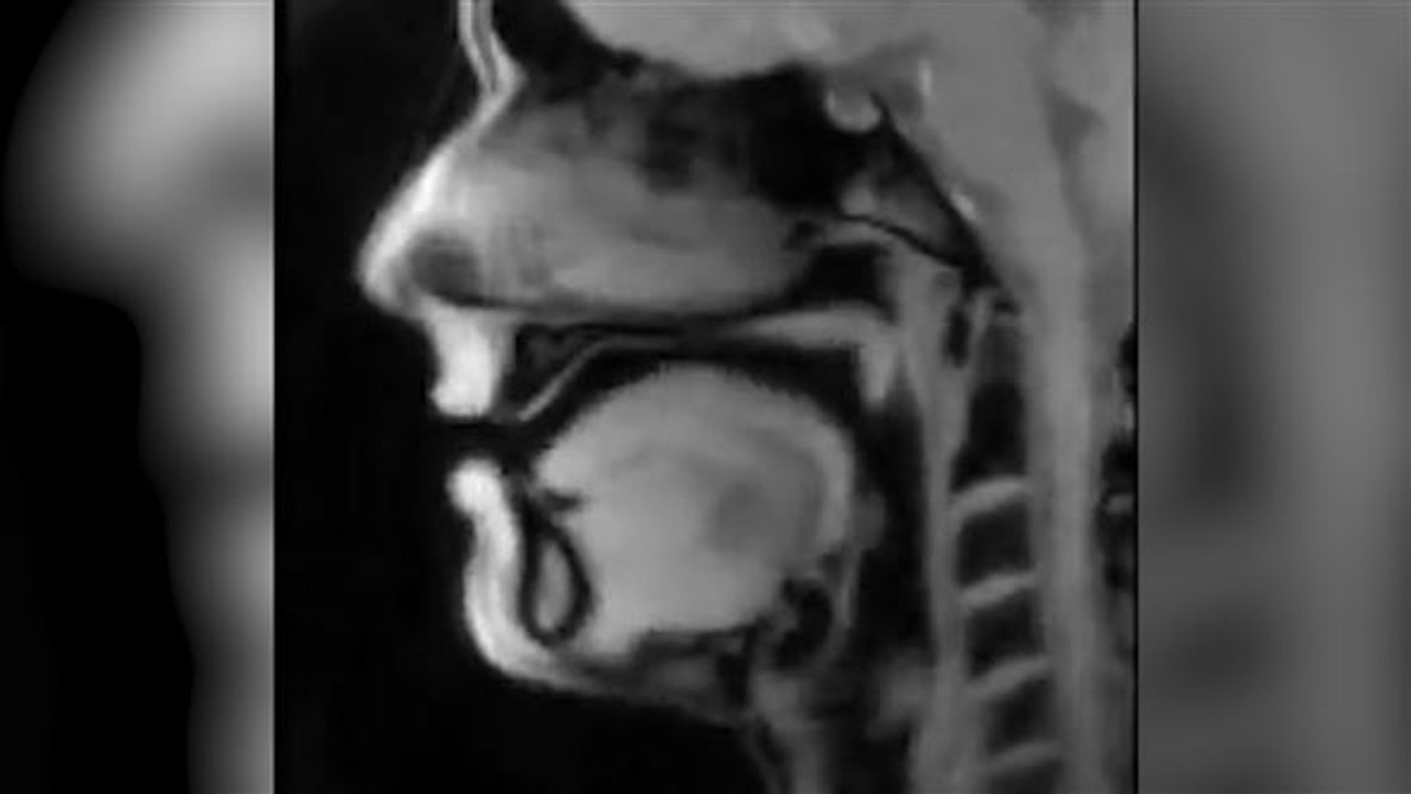 Lippenleser: echzeit-mrt filmt 'live' aus dem körper