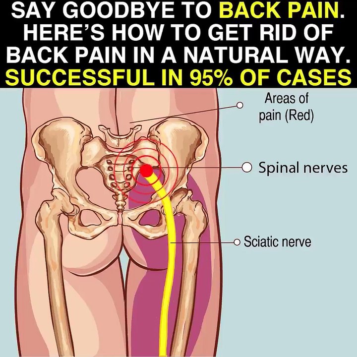 Say Goodbye To Back Pain