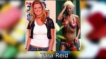 Celebrities Before and After Drugs - Terrible Photos