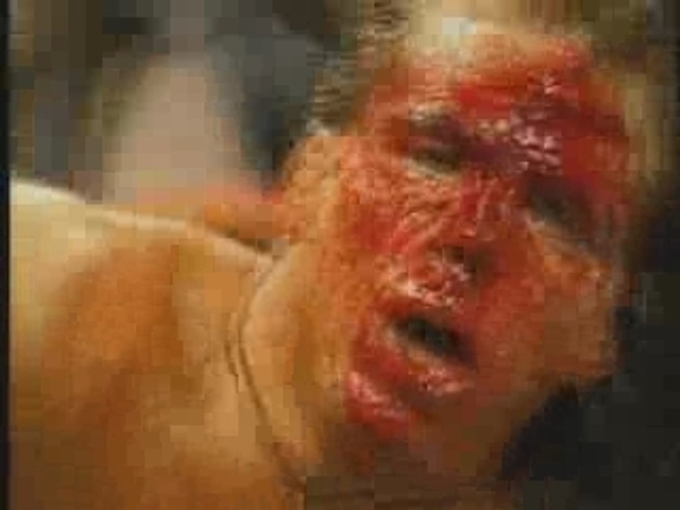Raw Opening: 1999