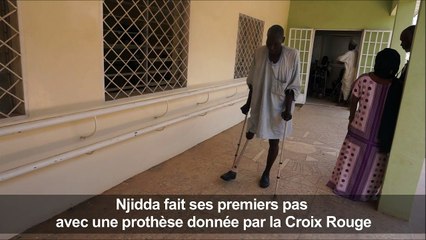 Des prothèses pour les rescapés des violences de Boko Haram