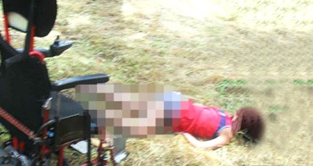 Engelli Kadını Dövüp Tekerlekli Sandalyesinden Atarak Kafasını ve 2 Bacağını Kırdılar