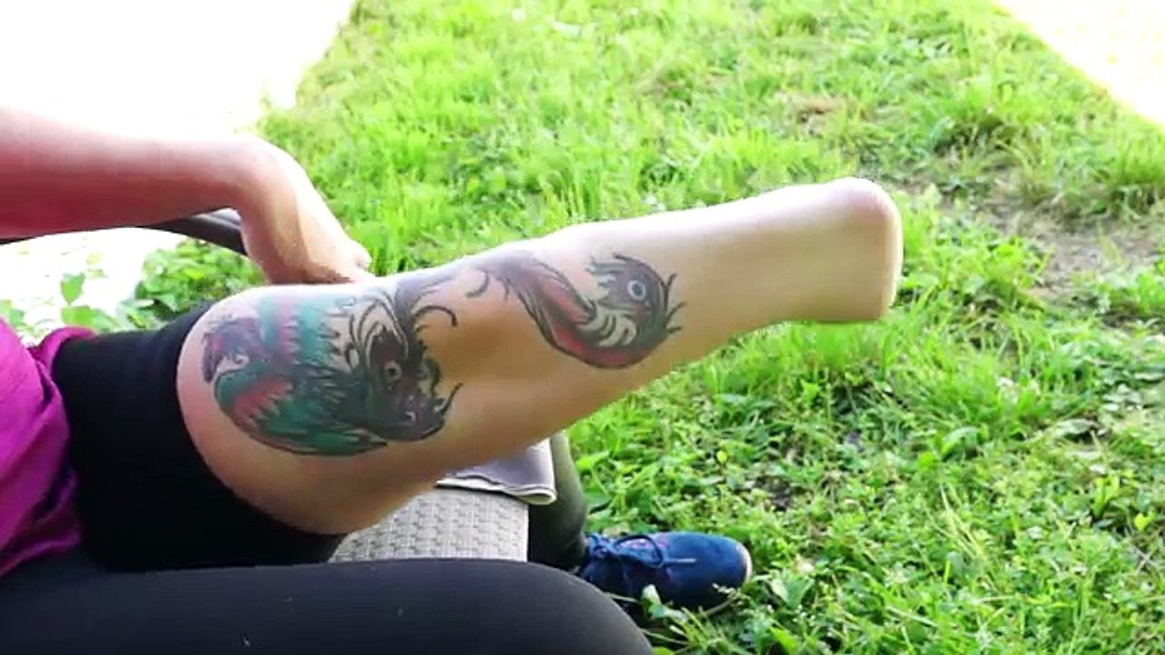 AmputeeOT: Up close and personal with matured (4 years) residual Limb Update *ASL*