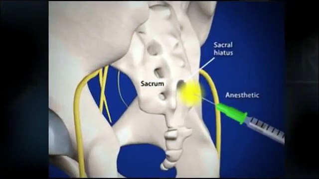 Pain Management Doctors in San Antonio Texas