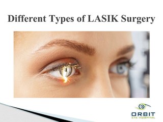 Different Types of LASIK Surgery