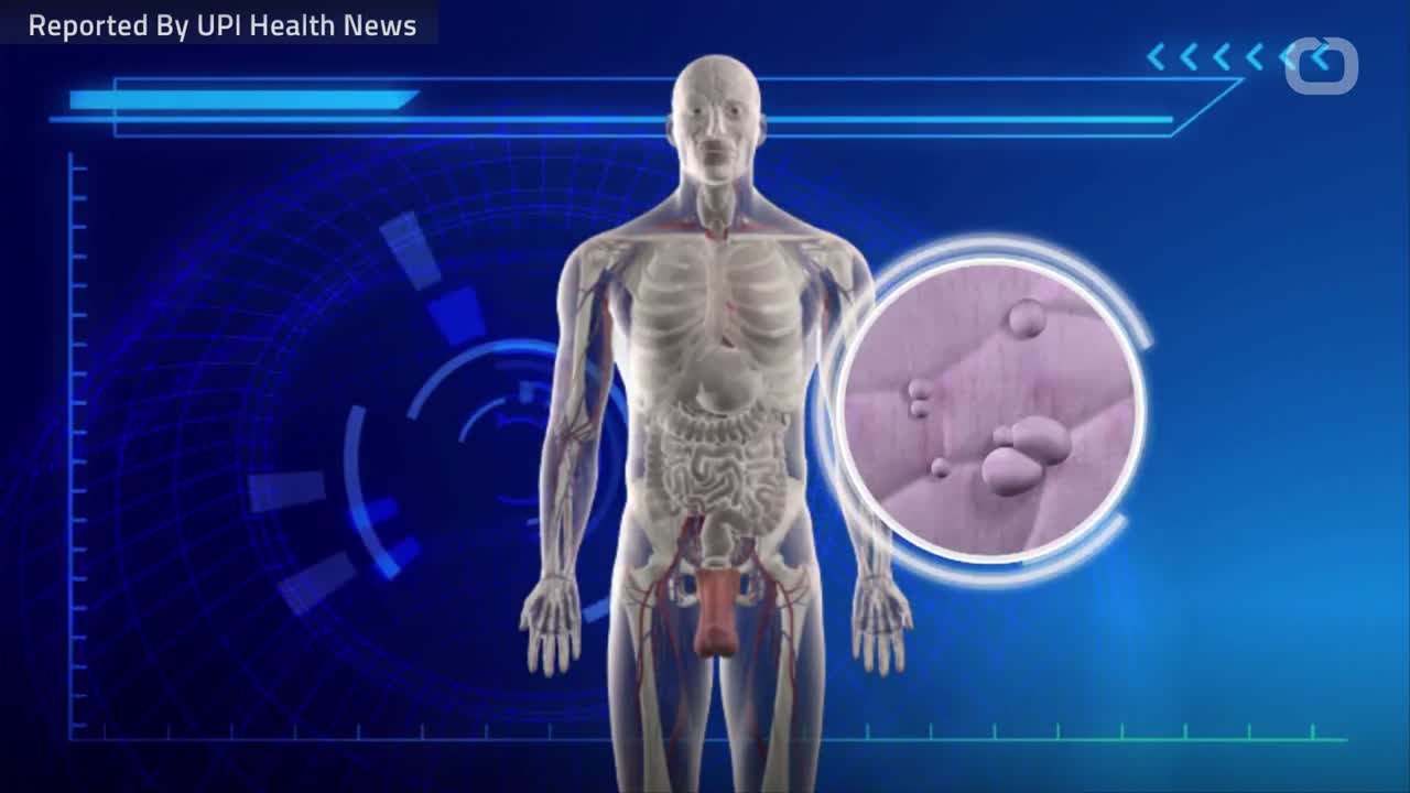 Uterine Cancer Treatment May Cause Cardiovascular Issues