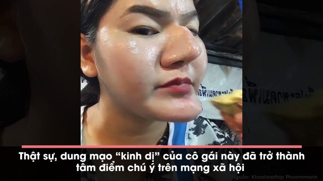 Sự thật phía sau “gương mặt phù thủy” của cô gái bị nghi là phẫu thuật hỏng