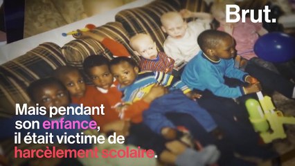 “Tu ne peux jamais être invisible.“ Atteint d’albinisme, le mannequin Leo Jonah a un message à faire passer